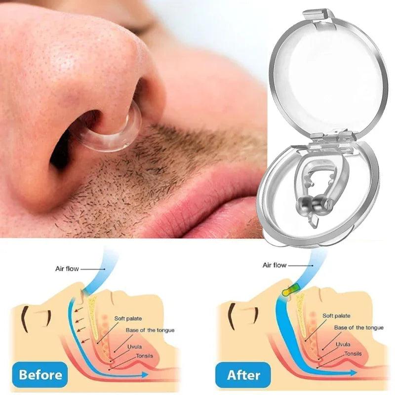 Sleep Easy: Anti-Snoring Corrector - StarsKing Technology