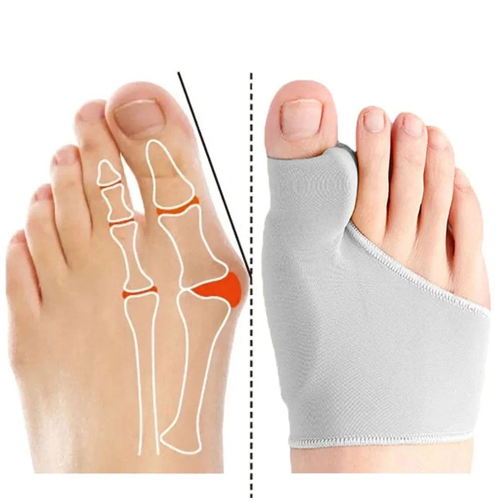 Toe Separator Bunion Corrector - StarsKing Technology